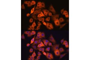 Immunofluorescence analysis of  cells using  Rabbit mAb (ABIN7265531) at dilution of 1:100 (40x lens). (ALDH1A1 antibody)