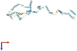 Nebulette Protein (NEBL) (AA 1-452) (His tag)