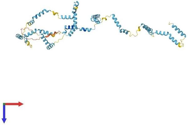 Nebulette Protein (NEBL) (AA 1-452) (His tag)