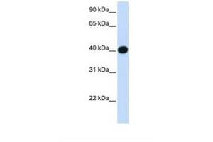 Image no. 1 for anti-Lipoic Acid Synthetase (LIAS) (AA 38-87) antibody (ABIN6738492) (LIAS antibody  (AA 38-87))