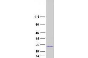 Western Blotting (WB) image for Ubiquitin-Conjugating Enzyme E2E 1 (UBE2E1) (Transcript Variant 2) protein (Myc-DYKDDDDK Tag) (ABIN2734805)
