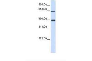 Image no. 1 for anti-IKAROS Family Zinc Finger 3 (Aiolos) (IKZF3) (C-Term) antibody (ABIN6737865) (IKZF3 antibody  (C-Term))