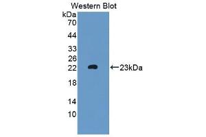 Detection of Recombinant MTMR9, Mouse using Polyclonal Antibody to Myotubularin Related Protein 9 (MTMR9) (MTMR9 antibody  (AA 1-167))