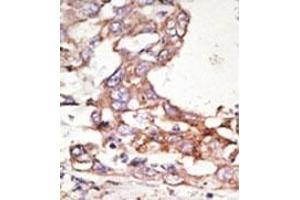 Image no. 2 for anti-Small Ubiquitin Related Modifier 4 (SUMO4) (Middle Region) antibody (ABIN356785)