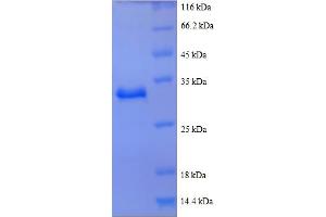 SDS-PAGE (SDS) image for Actin, beta (ACTB) (AA 102-375), (partial) protein (His tag) (ABIN5712171) (beta Actin Protein (AA 102-375, partial) (His tag))