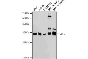 Western blot analysis of extracts of various cell lines, using CBR1 antibody (ABIN7266076) at 1:1000 dilution.