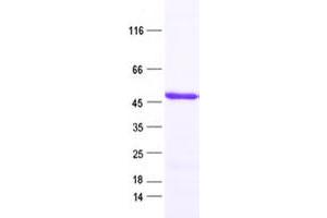 Validation with Western Blot (RBMY1A1 Protein (His tag))