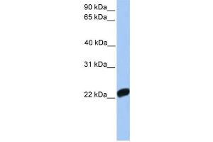 Western Blotting (WB) image for anti-Coagulation Factor X (F10) antibody (ABIN2458605) (Coagulation Factor X antibody)