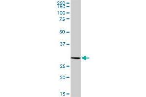 HIBADH MaxPab polyclonal antibody. (HIBADH antibody  (AA 1-336))