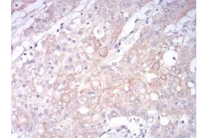 Immunohistochemistry (IHC) image for anti-Low Density Lipoprotein Receptor-Related Protein 1 (LRP1) (AA 20-155) antibody (ABIN5897030) (LRP1 antibody  (AA 20-155))