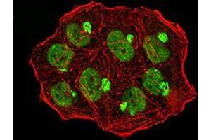 Immunocytochemistry (ICC) image for anti-Ubiquitin-Like, Containing PHD and RING Finger Domains, 1 (UHRF1) (AA 616-755) antibody (ABIN5542545)