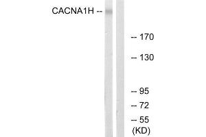 Western Blotting (WB) image for anti-Calcium Channel, Voltage-Dependent, T Type, alpha 1H Subunit (CACNA1H) (Internal Region) antibody (ABIN1852390) (CACNA1H antibody  (Internal Region))
