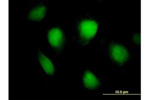 Immunofluorescence of purified MaxPab antibody to FHL1 on HeLa cell.