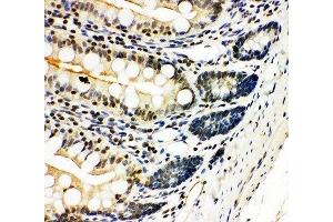 IHC-P: NFKB2 antibody testing of rat intestine tissue