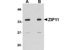 Western blot analysis of ZIP11 in mouse kidney tissue lysate with this product at (A) 1 and (B) 2 μg/ml. (SLC39A11 antibody  (Center))