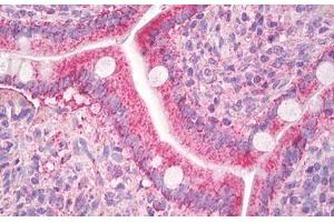 Image no. 1 for anti-Chemokine (C-C Motif) Ligand 8 (CCL8) (AA 24-99) antibody (ABIN1499347) (CCL8 antibody  (AA 24-99))