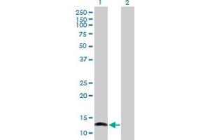 Western Blot analysis of NFATC2IP expression in transfected 293T cell line by NFATC2IP MaxPab polyclonal antibody. (NFATC2IP antibody  (AA 1-138))