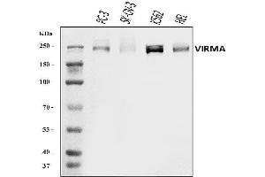 Western blot analysis of KI/VIRMA using anti-KI/VIRMA antibody (ABIN7599707). (Protein Virilizer Homolog (VIRMA) (AA 11-1529) antibody)