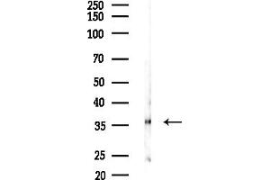 anti-Acyl-CoA Thioesterase 8 (ACOT8) (Internal Region) antibody