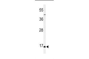 Western blot analysis of FB Antibody (C-term) (ABIN653927 and ABIN2843161) in MCF-7 cell line lysates (35 μg/lane). (BOD1 antibody  (C-Term))