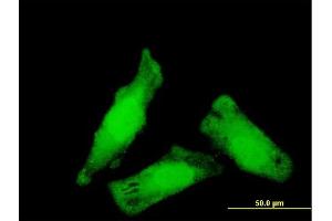 Immunofluorescence of monoclonal antibody to NIPBL on HeLa cell. (NIPBL antibody  (AA 66-175))