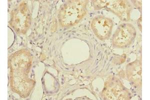 Immunohistochemistry of paraffin-embedded human kidney tissue using ABIN7159418 at dilution of 1:100 (MIER2 antibody  (AA 1-545))