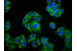 Immunofluorescence staining of HepG2 cells with ABIN7170935 at 1:100, counter-stained with DAPI. (SLC26A2 antibody  (AA 614-739))