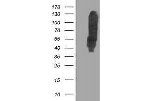 HEK293T cells were transfected with the pCMV6-ENTRY control (Left lane) or pCMV6-ENTRY DLD (Right lane) cDNA for 48 hrs and lysed. (DLD antibody)