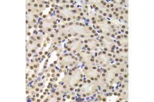 Immunohistochemistry of paraffin-embedded mouse kidney using PPP1R8 Antibody (ABIN5974046) at dilution of 1/100 (40x lens). (PPP1R8 antibody)
