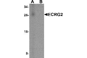 Western blot analysis of ECRG2 in human lung tissue lysate with ECRG2 antibody at 1 µg/mL in (A) the absence and (B) the presence of blocking peptide. (SPINK7/ECRG2 antibody  (C-Term))