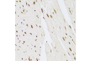Immunohistochemistry (Paraffin-embedded Sections) (IHC (p)) image for anti-Mitogen-Activated Protein Kinase 3 (MAPK3) (AA 1-100) antibody (ABIN3020725)