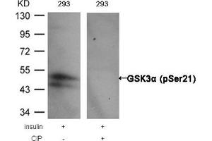 Western blot analysis of extracts from 293 cells, treated with insulin or calf intestinal phosphatase (CIP), using GSK3α (Phospho-Ser21) Antibody. (GSK3 alpha antibody  (pSer21))