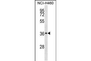 Western blot analysis in NCI-H460 cell line lysates (35ug/lane). (SERPINB1 antibody  (AA 168-196))