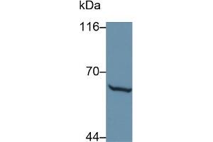 Detection of MMP1 in Caprine Skin lysate using Polyclonal Antibody to Matrix Metalloproteinase 1 (MMP1) (MMP1 antibody  (AA 98-275))