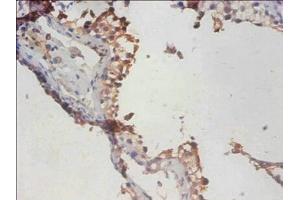 Immunohistochemistry of paraffin-embedded human testis tissue using ABIN7163064 at dilution of 1:100