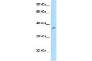 Image no. 1 for anti-Chromosome 7 Open Reading Frame 20 (C7orf20) (AA 32-81) antibody (ABIN6747992) (Chromosome 7 Open Reading Frame 20 (C7orf20) (AA 32-81) antibody)