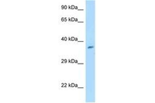 Chromosome 7 Open Reading Frame 20 (C7orf20) (AA 32-81) antibody