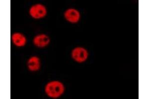 Immunofluorescence (fixed cells) (IF/ICC) image for anti-Signal Transducer and Activator of Transcription 1, 91kDa (STAT1) (pSer727) antibody (ABIN6256410)