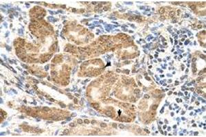 Immunohistochemical staining (Formalin-fixed paraffin-embedded sections) of human kidney with GMPPB polyclonal antibody  at 4-8 ug/mL working concentration. (GMPPB antibody  (C-Term))