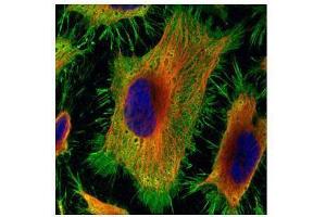 ICC/IF Image Confocal immunofluorescence analysis (Olympus FV10i) of paraformaldehyde-fixed HeLa, using Annexin II, antibody (Green) at 1:500 dilution. (Annexin A2 antibody  (N-Term))