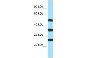 WB Suggested Anti-RAET1E Antibody Titration: 1.