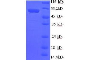 SDS-PAGE (SDS) image for Synapsin I (SYN1) (AA 113-420), (partial) protein (GST tag) (ABIN4976574) (SYN1 Protein (AA 113-420, partial) (GST tag))