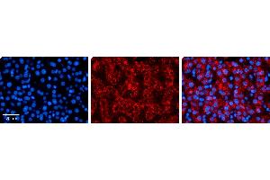 Immunohistochemistry (IHC) image for anti-Mitogen-Activated Protein Kinase Kinase 3 (MAP2K3) (N-Term) antibody (ABIN502211) (MAP2K3 antibody  (N-Term))