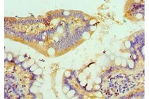 Immunohistochemistry of paraffin-embedded human small intestine tissue using ABIN7149059 at dilution of 1:100 (KAT14 antibody  (AA 523-782))