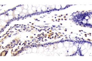 Detection of KMO in Human Colon Tissue using Polyclonal Antibody to Kynurenine-3-Monooxygenase (KMO) (KMO antibody  (AA 1-374))