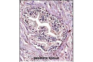 P4C Antibody (Center) (ABIN657678 and ABIN2846670) immunohistochemistry analysis in formalin fixed and paraffin embedded human prostate tissue followed by peroxidase conjugation of the secondary antibody and DAB staining. (PPP4C antibody  (AA 160-189))