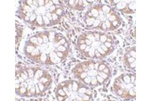 Immunohistochemistry of TEM1 in human colon tissue with this product at 2.