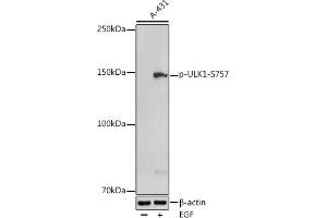 Western blot analysis of extracts of A-431 cells, using Phospho-ULK1-S757 antibody (ABIN6135334, ABIN6136284, ABIN6136285 and ABIN6225646) at 1:500 dilution. (ULK1 antibody  (pSer757))