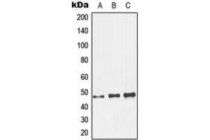 Western blot analysis of GCNT7 expression in HeLa (A), mouse kidney (B), rat kidney (C) whole cell lysates. (GCNT7 antibody  (C-Term))