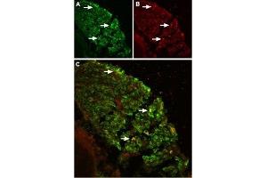 Expression of TRPV2 in mouse DRG - Immunohistochemical staining of TRPV2 in mouse dorsal root ganglion (DRG) using Anti-TRPV2 (VRL1) (extracellular) Antibody (ABIN7043845, ABIN7044002 and ABIN7044003). (TRPV2 antibody  (1st Extracellular Loop))
